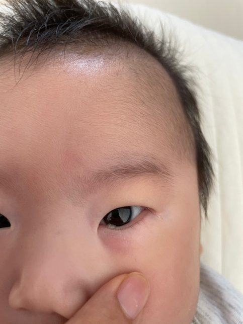 아기 눈밑에 눈꼽이 계속생겨요의 0번 째 이미지