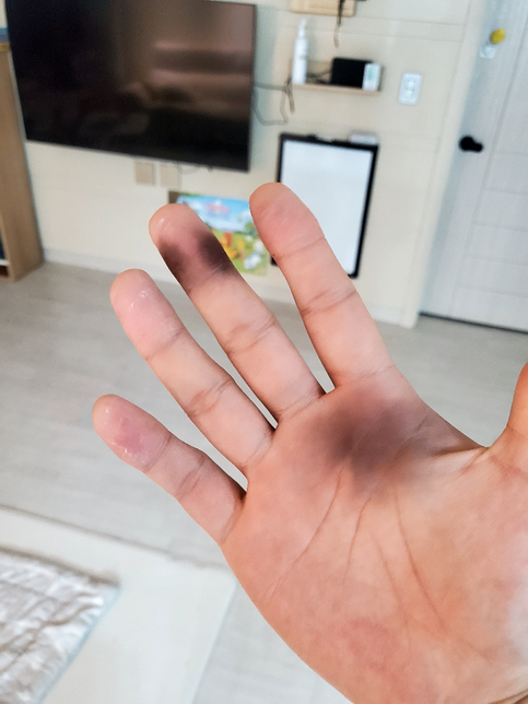 손바닥에 염색약이 묻었습니다.씻어도 안지워지는데 어떻게 해야하나요?의 0번 째 이미지