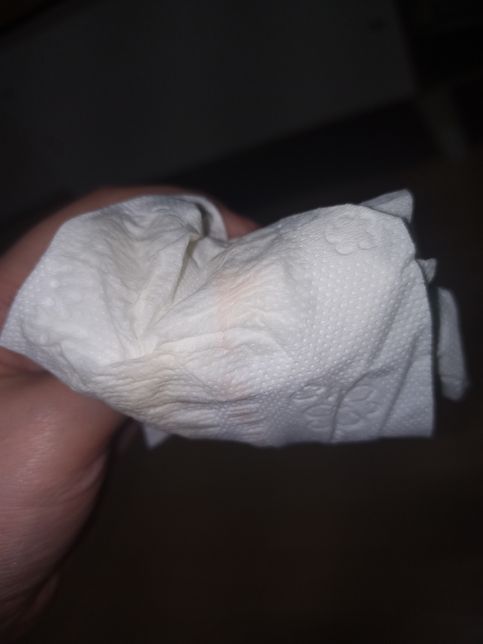 겐타마이신 크림이 원래 주황색 분홍색 뭔가가 나오나요?의 2번 째 이미지