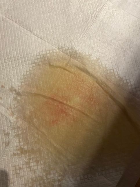 강아지 오줌에서 피 같은 게 섞여있는데 어떤 걸까요?의 0번 째 이미지