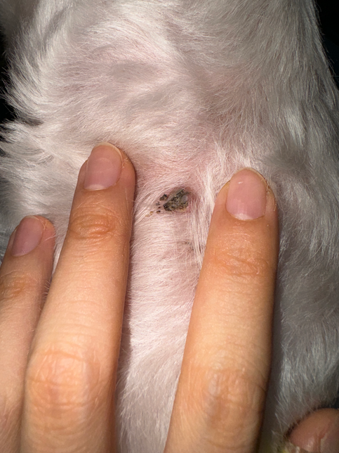 지방종을 긁어서 딱지가 생긴걸까요?의 0번 째 이미지