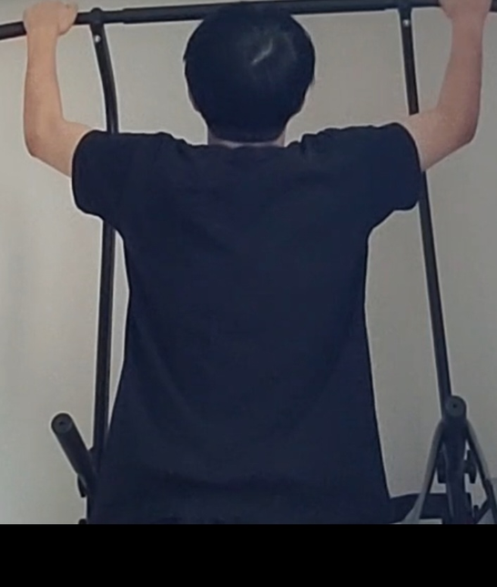 이정도면 정수리 탈모일까요?? 소견 한말씀 부탁드립니다의 0번 째 이미지