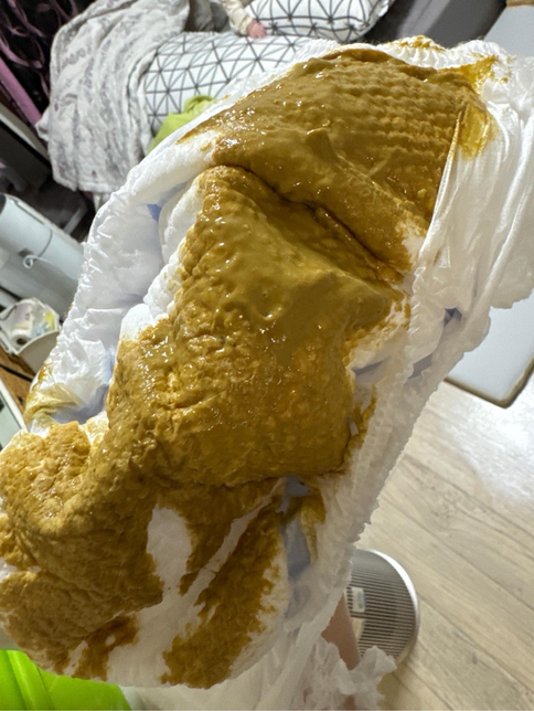 이제 7개월차되가는아기입니다 설사일까요?의 0번 째 이미지