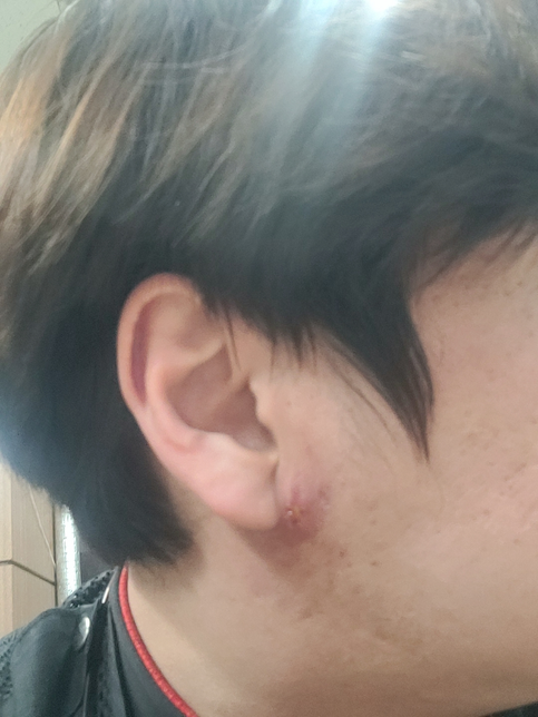 면역력이 많이 약해졌나봐요. 면역력에 좋은 식단이 있을까요??의 0번 째 이미지