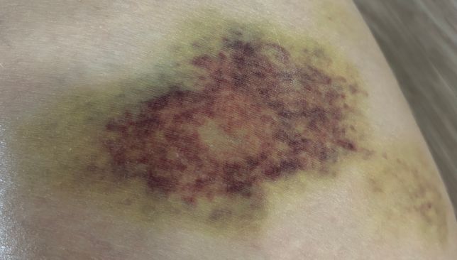 친오빠의 폭력, 신고와 처벌 가능한가요의 0번 째 이미지