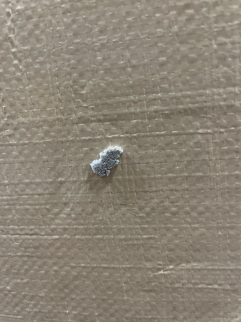 이거 벌레알인가요…? 뭔지 잘모르겠어요의 1번 째 이미지