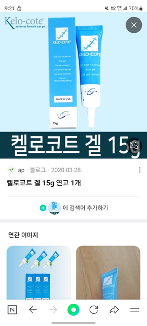 입원 흉터연고 실비 적용 되나요?의 0번 째 이미지