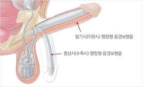 "그냥 피곤해서 그런 거겠지" — 발기부전, 언제부터 질환으로 볼까요?